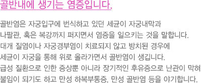 골반내에 생기는 염증입니다.
							  골반염은 자궁입구에 번식하고 있던 세균이 자궁내막과
							  나팔관, 혹은 복강까지 퍼지면서 염증을 일으키는 것을 말합니다.
							  대개 질염이나 자궁경부염이 치료되지 않고 방치된 경우에
							  세균이 자궁을 통해 위로 올라가면서 골반염이 생깁니다.
							  급성 질환으로 인한 증상뿐 아니라 장기적인 후유증으로 난관이 막혀
							  불임이 되기도 하고 만성 하복부통증, 만성 골반염 등을 야기합니다.