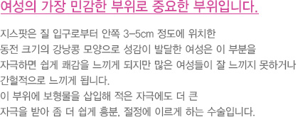 여성의 가장 민감한 부위로 중요한 부위입니다.
							  지스팟은 질 입구로부터 안쪽 3-5cm 정도에 위치한 
							  동전 크기의 강낭콩 모양으로 성감이 발달한 여성은 이 부분을 
							  자극하면 쉽게 쾌감을 느끼게 되지만 많은 여성들이 잘 느끼지 못하거나 
							  간헐적으로 느끼게 됩니다. 
							  이 부위에 보형물을 삽입해 적은 자극에도 더 큰
							  자극을 받아 좀 더 쉽게 흥분, 절정에 이르게 하는 수술입니다.