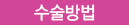 수술방법