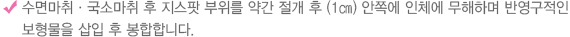 수면마취·국소마취 후 지스팟 부위를 약간 절개 후 (1㎝) 안쪽에 인체에 무해하며 반영구적인 보형물을 삽입 후 봉합합니다.