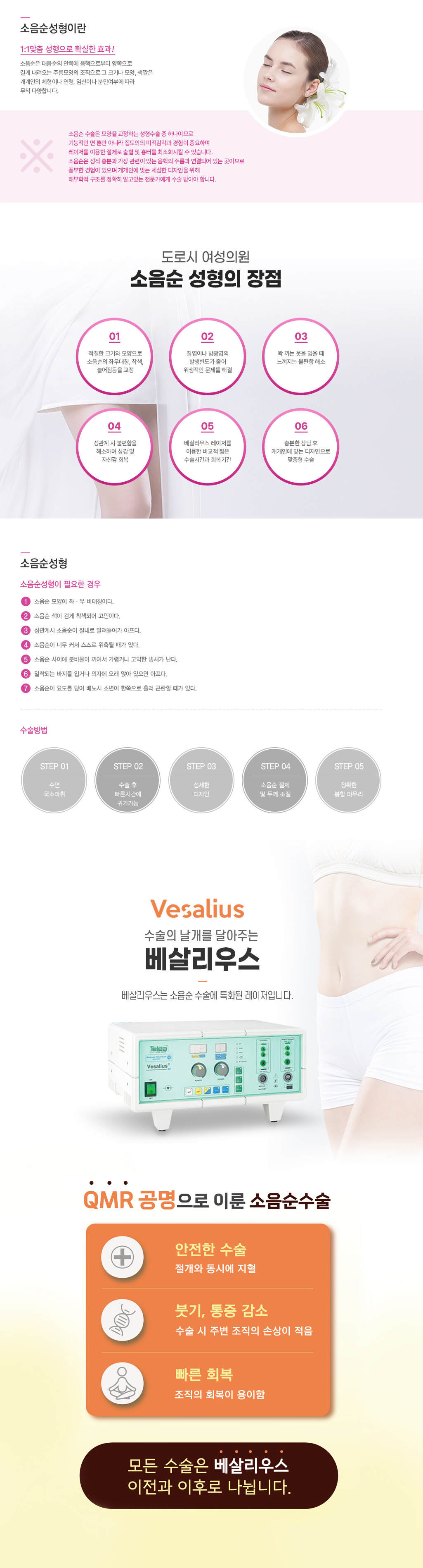 소음순성형이란